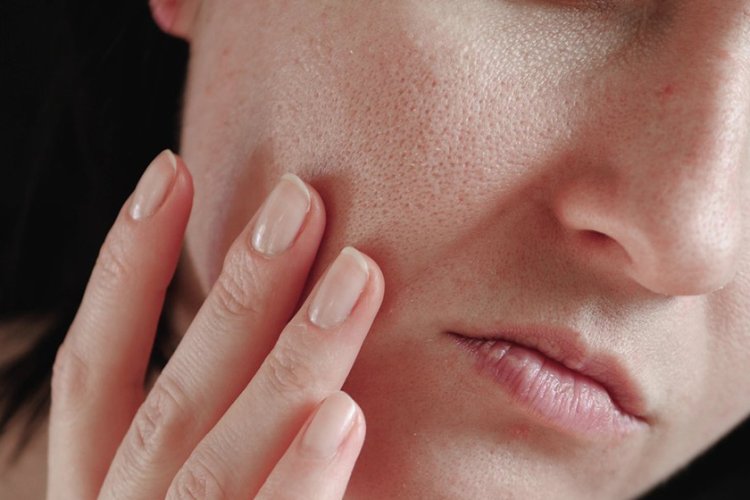 مع دخول فصل الشتاء.. إليكٍ 6 نصائح للحفاظ علي بشرتك من الجفاف
