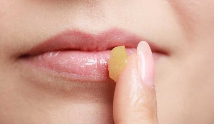 4 وصفات  طبيعية لإزالة تجاعيد الفم