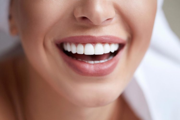 تعرف على 4 وصفات طبيعة للحصول على أسنان بيضاء