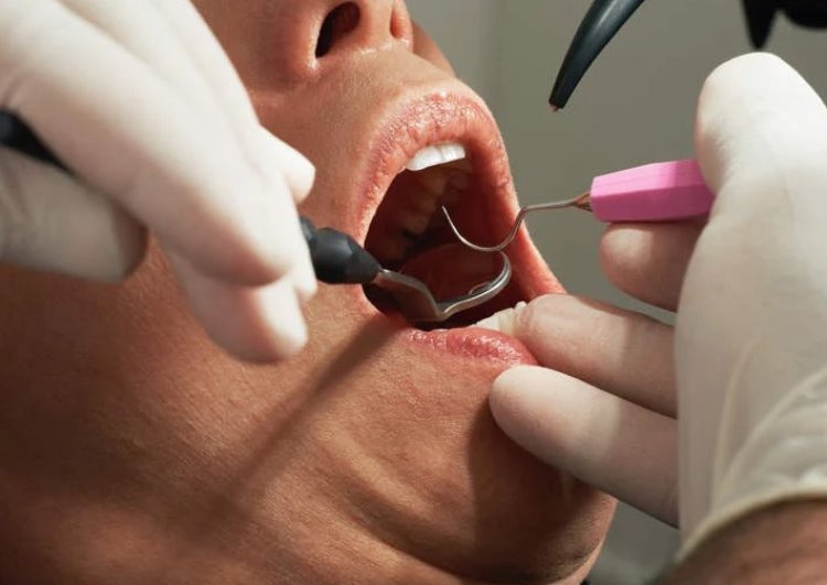 منظف ​​عيادة أسنان ينتحل شخصية طبيب ويخلع أسنان رجل